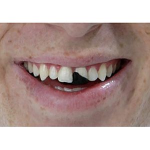 Rubies Tooth Wax